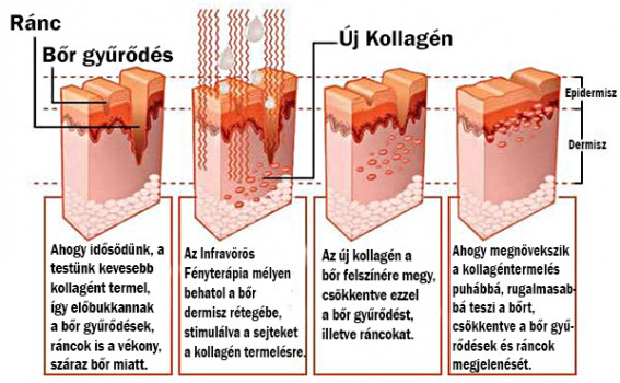 kollagén.fordítva